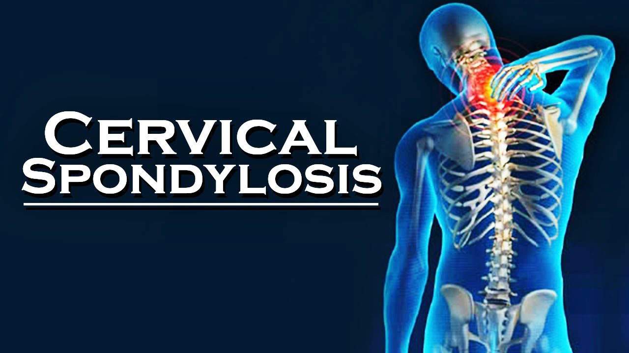 Say good…bye to Neck Pain and Cervical Spondylosis!