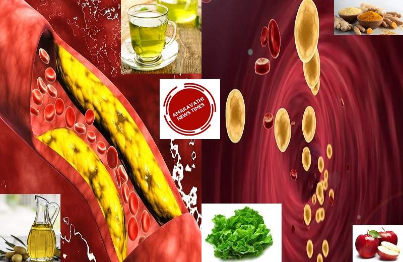 Home Remedies and Tips to Remove Unnecessary Fat in Blood Vessels