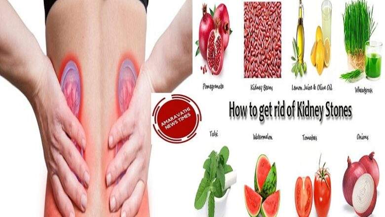 How to Reduce Kidney Stones in Natural Ways without Medicines | Symptoms | Treatment